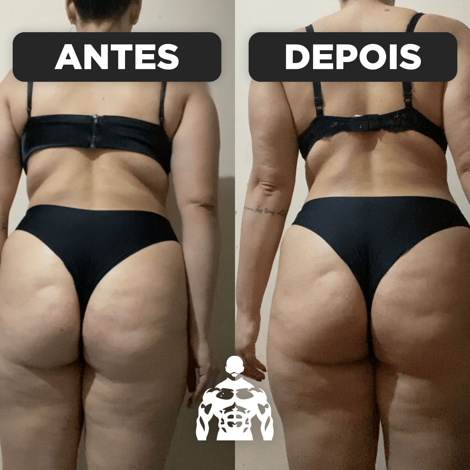 Antes e Depois - João Macedo