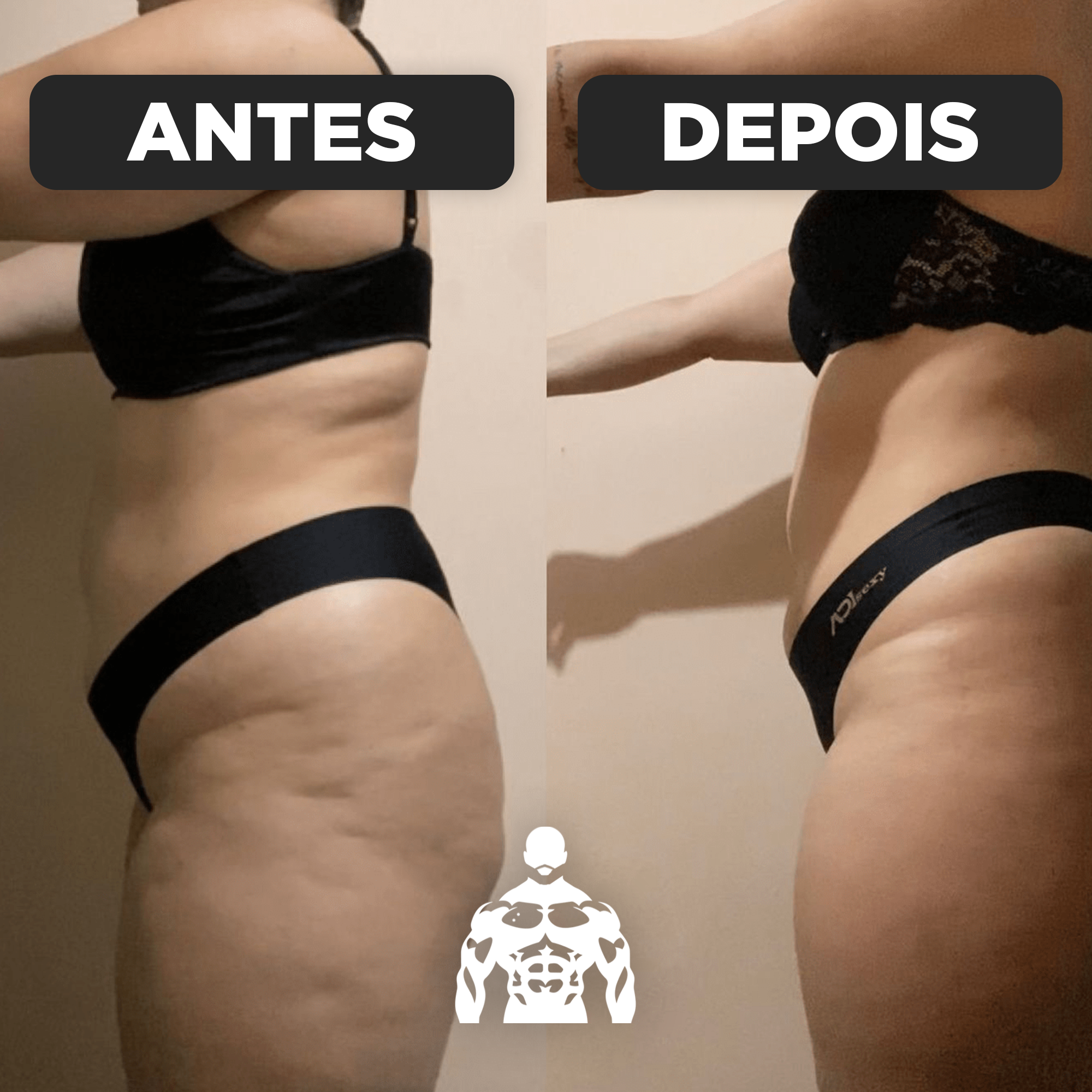 Antes e Depois - João Macedo