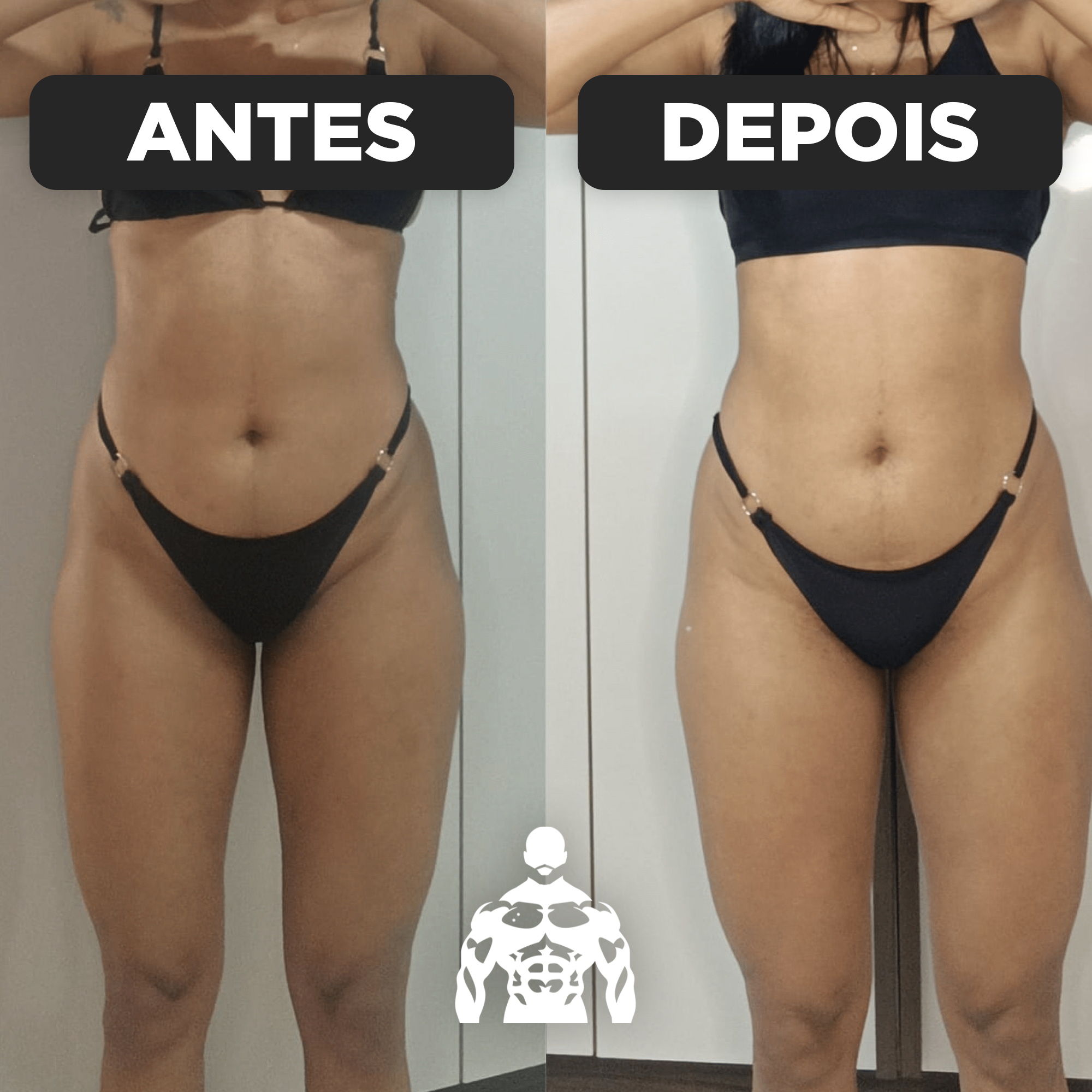 Antes e Depois - João Macedo